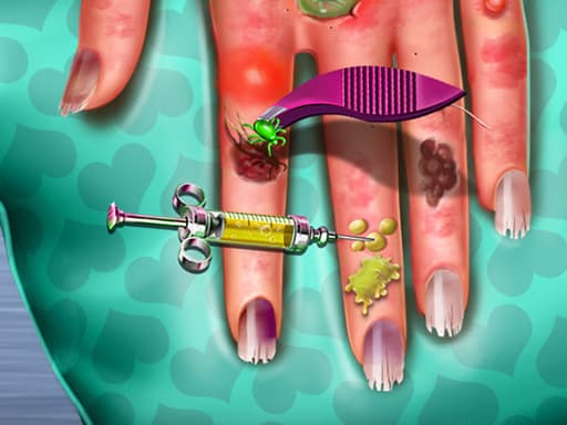 free online games - Hand Skin Doctor