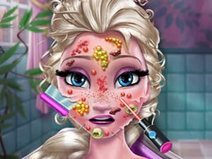 free online games - Ice Queen Skin Doctor