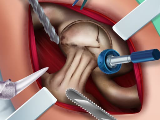 free online games - Ella Hip Surgery